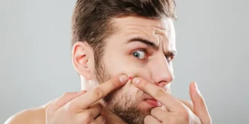 confiance en soi peau belle lemirak visage